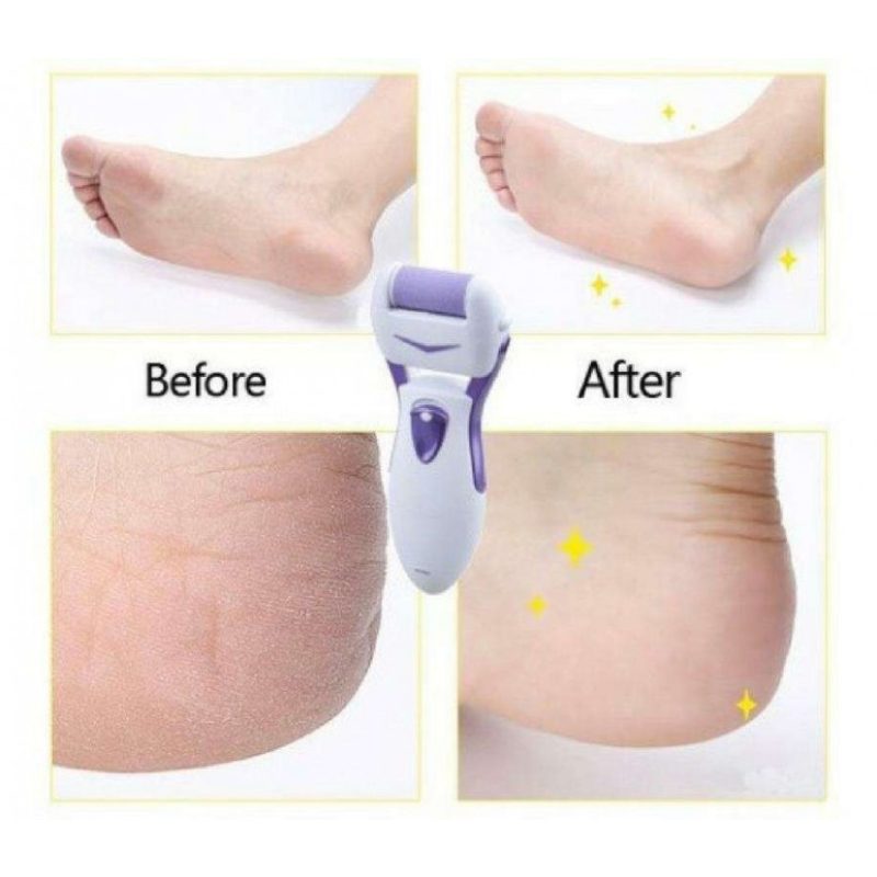 Pedicure elettrico dispositivo calli cura piedi pelle roll benessere SH-7663 
