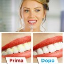 Sonic Pic Dispositivo Pulizia denti 3000 Vibrazioni Ablatore Sbiancante Tartaro
