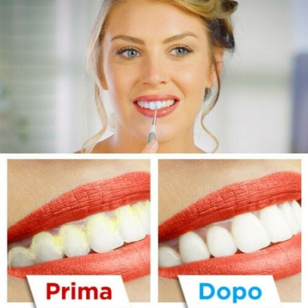 Sonic Pic Dispositivo Pulizia denti 3000 Vibrazioni Ablatore Sbiancante Tartaro