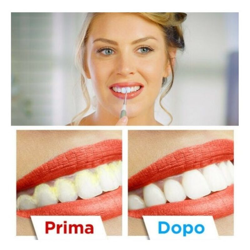 DOBO Sonic Pic Dispositivo Pulizia denti 3000 Vibrazioni Ablatore S...