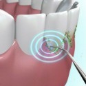 Sonic Pic Dispositivo Pulizia denti 3000 Vibrazioni Ablatore Sbiancante Tartaro