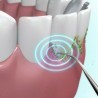 DOBO Sonic Pic Dispositivo Pulizia denti 3000 Vibrazioni Ablatore S...