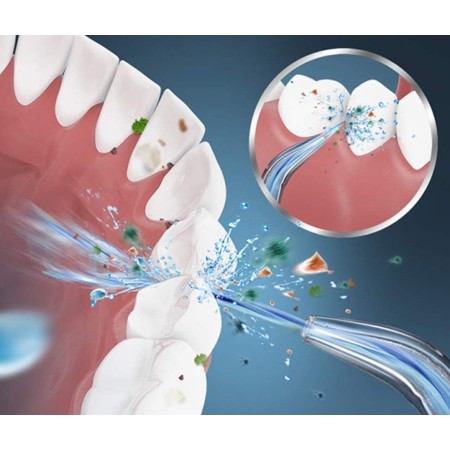 Idropulsore dentale professionale Irrigatore Orale Denti Elettrico gengive usb
