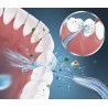 DOBO Idropulsore dentale professionale Irrigatore Orale Denti Elett...