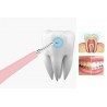 Generico PULIZIA DENTI AD ULTRASUONI RIMOZIONE TARTARO PLACCA MACCH...