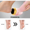 Rimuovi elimina calli elettrico portatile ricaricabile duroni piedi pedicure 8W